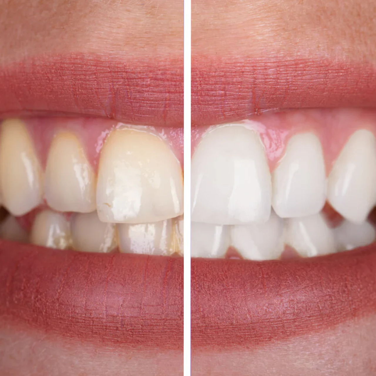 niacinamide whitening toothpaste
